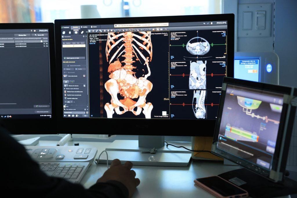 Hospital Arnulfo Arias estrena tomógrafo IA