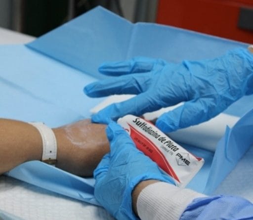 Quemaduras infantiles: CSS alerta por aumento en fin de año en Panamá