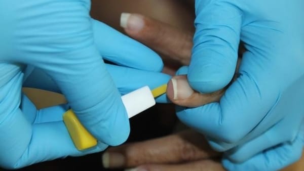 CSS advierte sobre ETS en Carnaval 2026